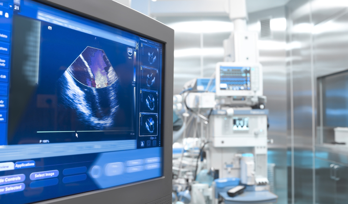 Heart ultrasound on monitor in hospital