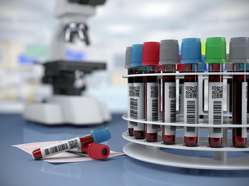 Close-up of a collector carousel holding blood vials, prepared for a lipid profile to assess high cholesterol