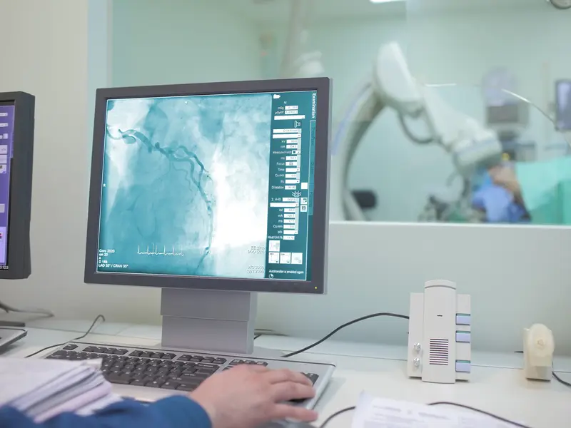 close up of CT cardiovascular imaging showing patient's risk of heart attack