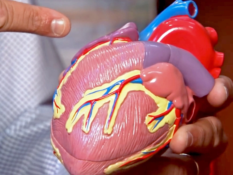 Still image from Manish Assar, MD Arrhythmia Heart video