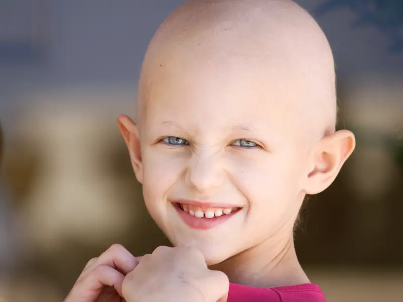 young child smiling at camera with loss of hair due to pediatric medical condition