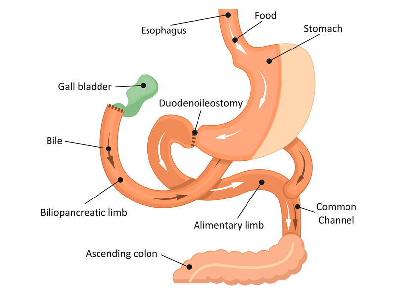 Stomach diagram