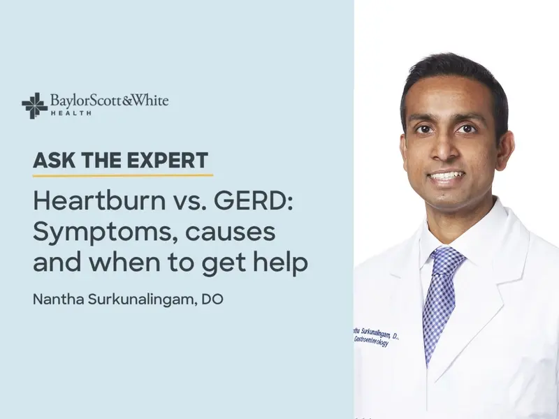 Ask the Expert Heartburn vs GERD