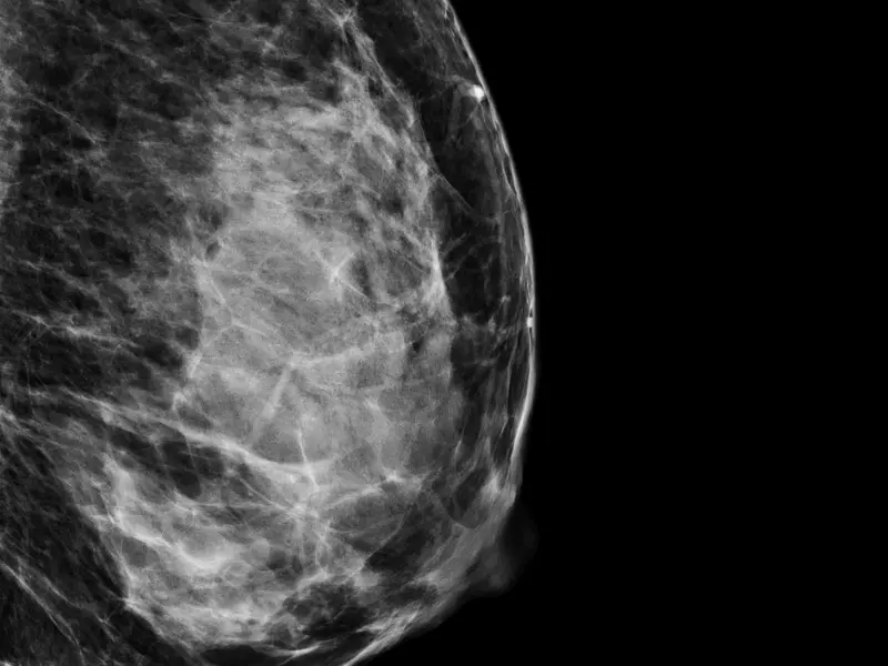What Does It Mean to Have 'Dense' Breasts?