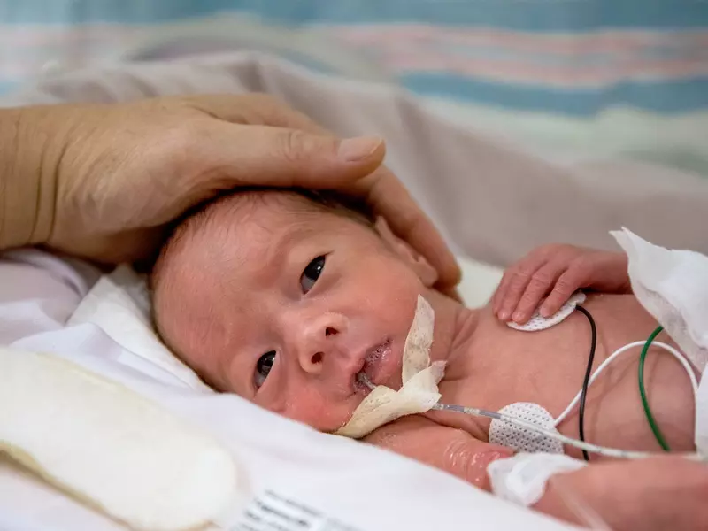 Closeup of a newborn baby in a NICU unit with tubes in his mouth and wires on his chest, as a parent's hand gently caresses his head