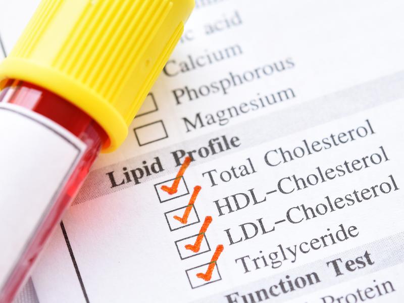  Close-up of a blood vial and lipid profile report displaying total cholesterol, HDL, LDL, and triglyceride levels